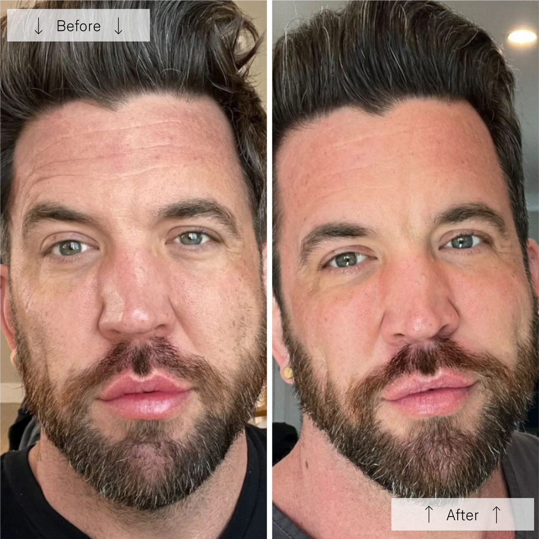 Omnilux Men